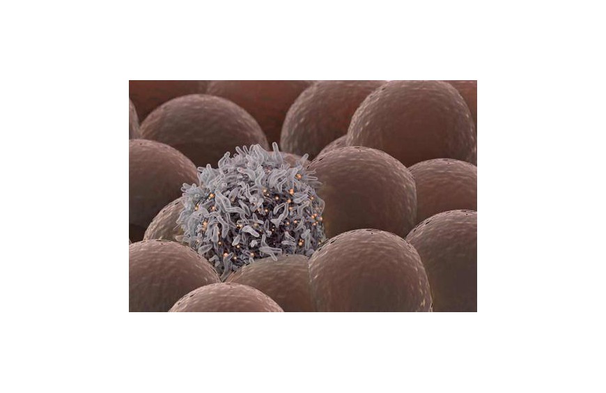 Olejki CBD wykorzystanie w chorobach onkologicznych.